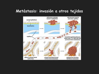 Metástasis: invasión a otros tejidos
 
