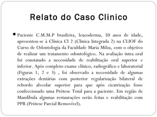 Relato do Caso Clinico
Paciente C.M.M.P brasileira, leucoderma, 50 anos de idade,
apresentou-se à Clínica CI 2 (Clinica Integrada 2) na CLIOF do
Curso de Odontologia da Faculdade Maria Milza, com o objetivo
de realizar um tratamento odontológico. Na avaliação intra oral
foi constatado a necessidade de reabilitação oral superior e
inferior. Após completo exame clínico, radiográfico e laboratorial
(Figuras 1, 2 e 3) , foi observado a necessidade de algumas
extrações dentárias com posterior regularização bilateral de
rebordo alveolar superior para que após cicatrização fosse
confeccionado uma Prótese Total para a paciente. Em região de
Mandíbula algumas restaurações serão feitas e reabilitação com
PPR (Prótese Parcial Removível).
 