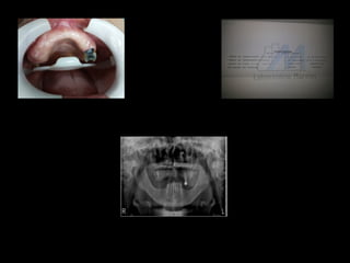 Figura 1: Fonte Própria
Figura 2: Fonte Própria
Figura 3: Fonte Própria
 