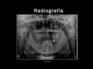 Radiografia
Fonte Própria
 