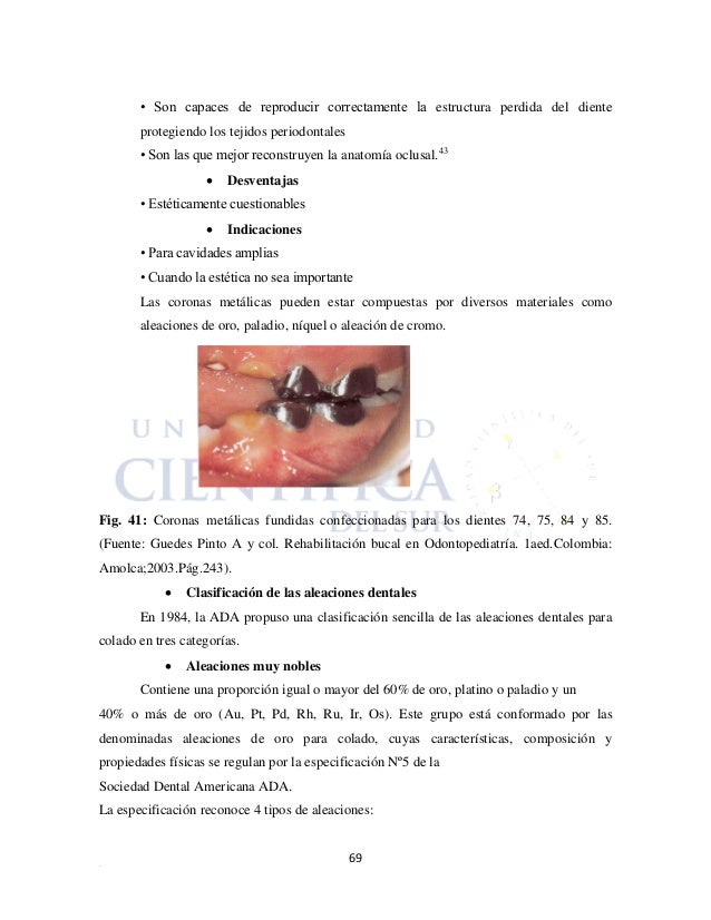 Rehabilitación de dientes anteriores temporales con Rehabilitación de dientes anteriores temporales con