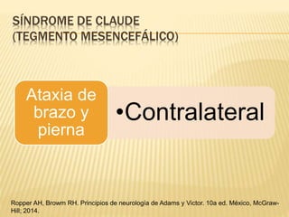 SÍNDROME DE CLAUDE
(TEGMENTO MESENCEFÁLICO)
•Contralateral
Ataxia de
brazo y
pierna
Ropper AH, Browm RH. Principios de neurología de Adams y Victor. 10a ed. México, McGraw-
Hill; 2014.
 