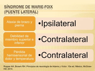 SÍNDROME DE MARIE-FOIX
(PUENTE LATERAL)
•IpsilateralAtaxia de brazo y
pierna
•Contralateral
Debilidad de
miembro superior e
inferior
•Contralateral
Pérdida
hemisensorial de
dolor y temperatura
Ropper AH, Browm RH. Principios de neurología de Adams y Victor. 10a ed. México, McGraw-
Hill; 2014.
 
