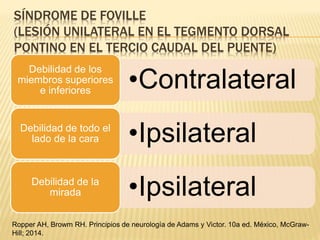 SÍNDROME DE FOVILLE
(LESIÓN UNILATERAL EN EL TEGMENTO DORSAL
PONTINO EN EL TERCIO CAUDAL DEL PUENTE)
•Contralateral
Debilidad de los
miembros superiores
e inferiores
•IpsilateralDebilidad de todo el
lado de la cara
•IpsilateralDebilidad de la
mirada
Ropper AH, Browm RH. Principios de neurología de Adams y Victor. 10a ed. México, McGraw-
Hill; 2014.
 
