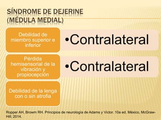 SÍNDROME DE DEJERINE
(MÉDULA MEDIAL)
•Contralateral
Debilidad de
miembro superior e
inferior
•Contralateral
Pérdida
hemisensorial de la
vibración y
propiocepción
Debilidad de la lenga
con o sin atrofia
Ropper AH, Browm RH. Principios de neurología de Adams y Victor. 10a ed. México, McGraw-
Hill; 2014.
 