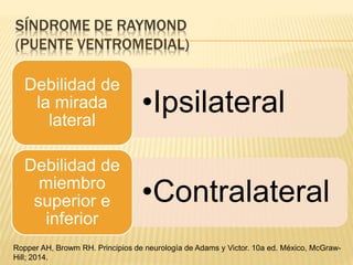 SÍNDROME DE RAYMOND
(PUENTE VENTROMEDIAL)
•Ipsilateral
Debilidad de
la mirada
lateral
•Contralateral
Debilidad de
miembro
superior e
inferior
Ropper AH, Browm RH. Principios de neurología de Adams y Victor. 10a ed. México, McGraw-
Hill; 2014.
 