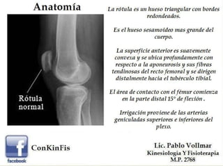 Rehabilitación en las distintas Fracturas de Rótula.PDF