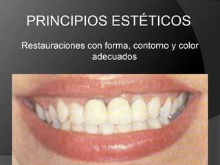 Técnicas anestésicasCalor generadoCalidad de las fresas y de la turbinaCantidad de dentina remanenteProcedimientos de impresión y materialesGrado de Filtración Marginal