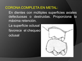 Planificación Del Tratamiento En Restauraciones UnitariasRestauraciones Extracoronarias