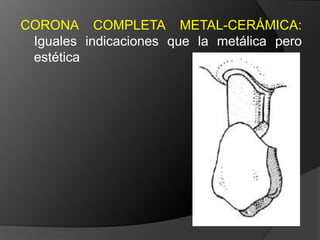Estructura coronaria insuficiente para retener la restauración dentro de la corona del dienteEstructura dentaria defectuosa o socavadaModificar los contornos para mejorar la oclusión o la estética