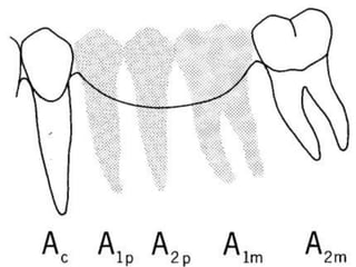 Tylman: afirmó que dos dientes pilares son capaces de soportar dos póntIcos.Johnston y col.: LEY DE ANTELa superficie radicular de los dientes pilares, con soporte óseo periodontal, debe ser mayor o igual a la de los dientes a sustituir con pónticos