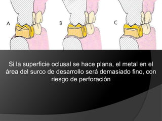 Reducción OclusalDebe tallarse suficiente tejido dental de la 	superficie oclusal de la preparación de tal 	manera que cuando la restauración se 	construya según la oclusión ideal,  tenga 	el grosor suficiente que prevenga su 	desgaste o su distorsión.