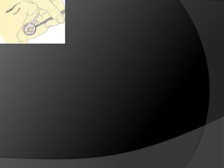 Introducción a la Prótesis Fija