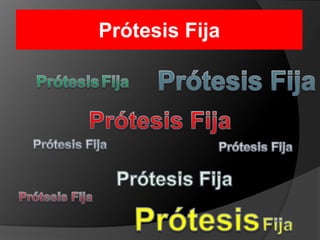 Prótesis FijaPrótesis FijaPrótesisFijaPrótesis FijaPrótesis FijaPrótesis FijaPrótesis FijaPrótesisFijaPrótesisFija