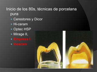 Inicio de los 80s, técnicas de porcelana puraCerestores y DicorHi-ceramOptec HSPMirage II, Empress IInceram