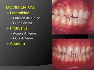 MOVIMIENTOS:LateralidadFunción de GrupoGuía CaninaProtrusivaAcople AnteriorGuía AnteriorApertura