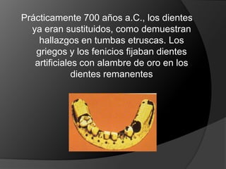 Prácticamente 700 años a.C., los dientes ya eran sustituidos, como demuestran hallazgos en tumbas etruscas. Los griegos y los fenicios fijaban dientes artificiales con alambre de oro en los dientes remanentes