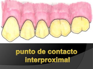 punto de contacto interproximal