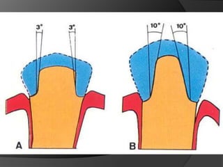 PRINCIPIOS MECÁNICOSRetenciónResistencia o EstabilidadRigidez EstructuralIntegridad Marginal 