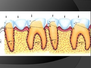 PRINCIPIOS MECÁNICOSRetenciónResistencia o EstabilidadRigidez EstructuralIntegridad Marginal 