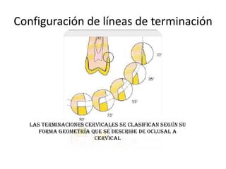 integridad marginal y preservacion del periodonto | PPTX
