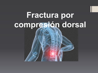 Fractura por
compresión dorsal
 