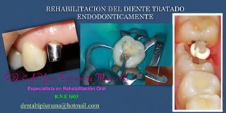 REHABILITACION DEL DIENTE TRATADO
ENDODONTICAMENTE
CD. ESP. Juan Tipismana Mancilla
Especialista en Rehabilitación Oral
R.N.E 1603
dentaltipismana@hotmail.com
 