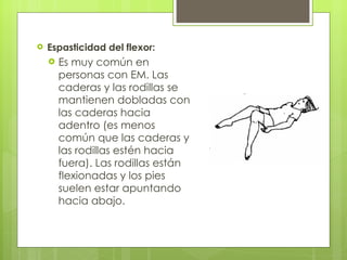 Espasticidad del flexor: Es muy común en personas con EM. Las caderas y las rodillas se mantienen dobladas con las caderas hacia adentro (es menos común que las caderas y las rodillas estén hacia fuera). Las rodillas están flexionadas y los pies suelen estar apuntando hacia abajo. 