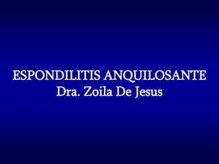 ESPONDILITIS ANQUILOSANTE
     Dra. Zoila De Jesus
 
