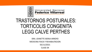 TRASTORNOS POSTURALES:
TORTICOLIS CONGENITA
LEGG CALVE PERTHES
DRA. JEANETTE BORJA ARROYO
MEDICINA FISICA Y REHABILITACION
05/11/2021
CLASE 04
 