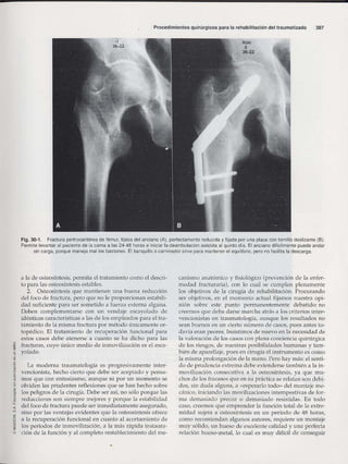 Rehabilitacion gonzález más