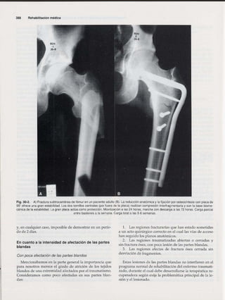 Rehabilitacion gonzález más