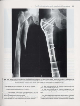 Rehabilitacion gonzález más