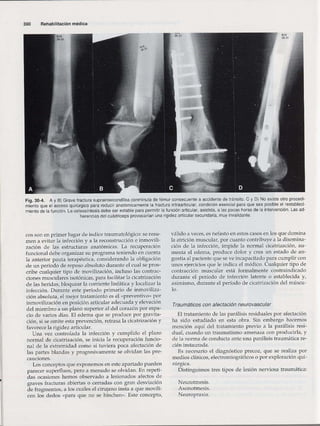 Rehabilitacion gonzález más