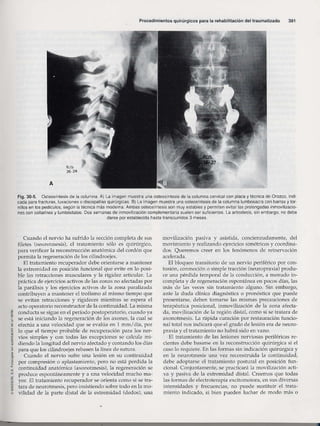 Rehabilitacion gonzález más