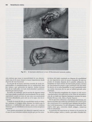 Rehabilitacion gonzález más