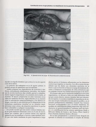 Rehabilitacion gonzález más