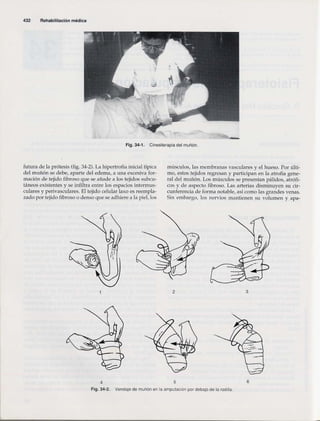 Rehabilitacion gonzález más