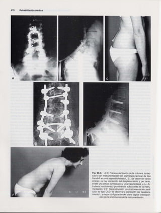 Rehabilitacion gonzález más