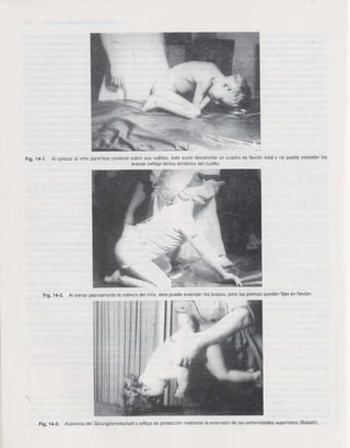 Rehabilitacion gonzález más