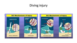 Rehabilitation for spinal cord injured people | PPTX