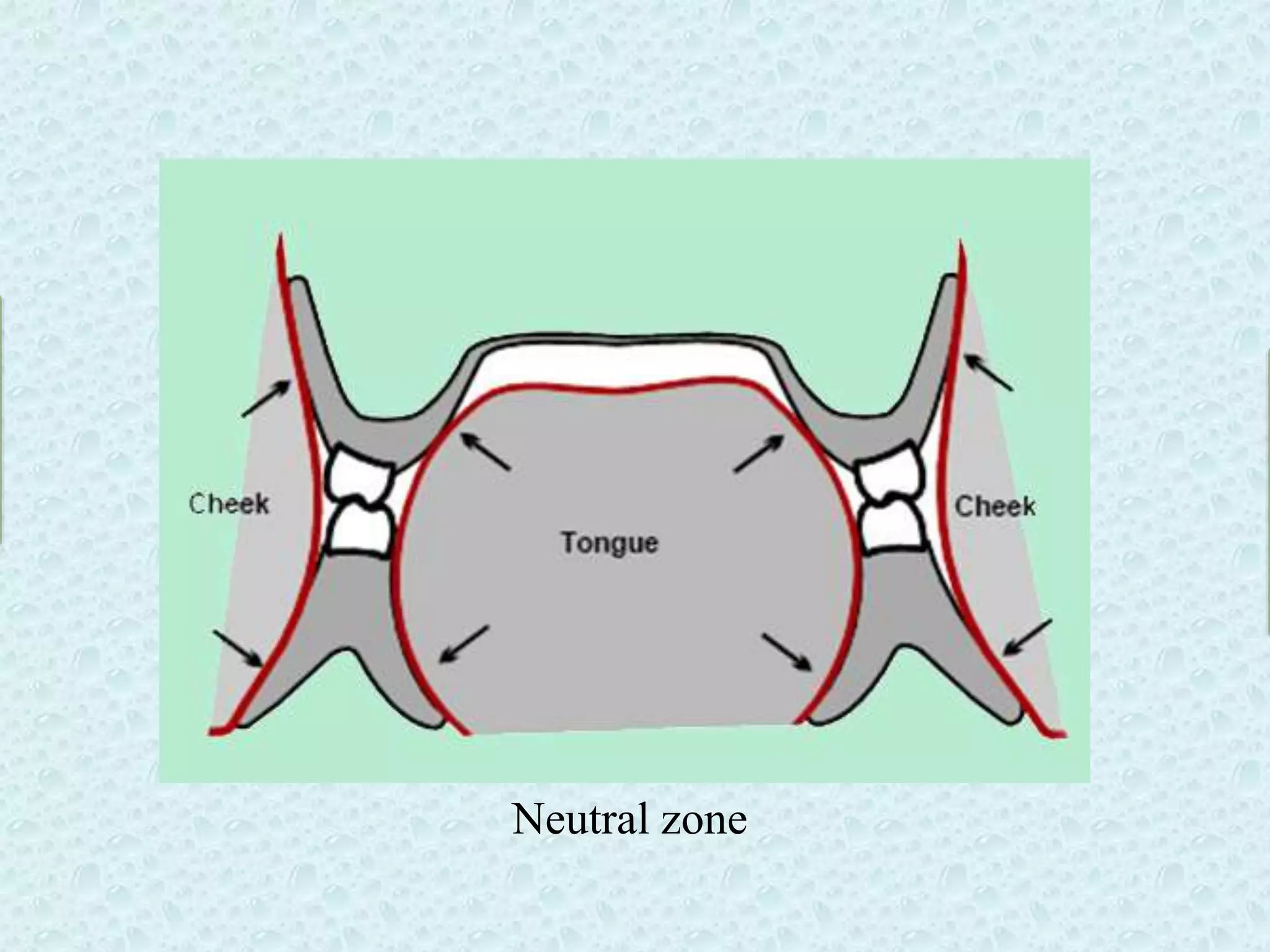 Rehabilitation of a patient with severely resorbed mandibularfinal | PPTX