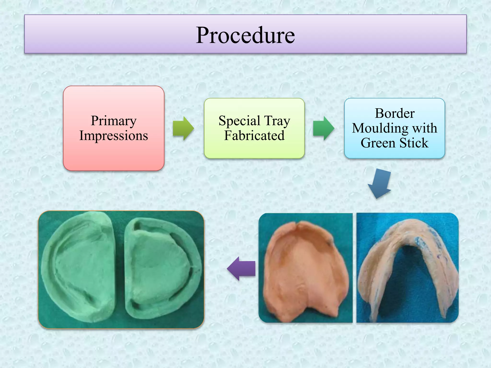 Rehabilitation of a patient with severely resorbed mandibularfinal | PPTX