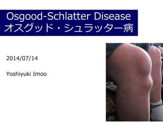 Osgood-Schlatter Disease
オスグッド・シュラッター病
2014/07/14
Yoshiyuki Imoo
 