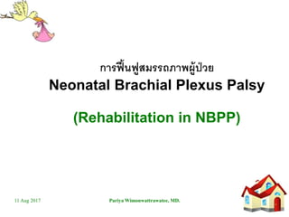 11 Aug 2017 Pariya Wimonwattrawatee, MD.
การฟื้นฟูสมรรถภาพผู้ป่วย
Neonatal Brachial Plexus Palsy
(Rehabilitation in NBPP)
 