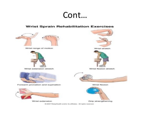 47  Can you workout with a sprained wrist for Women