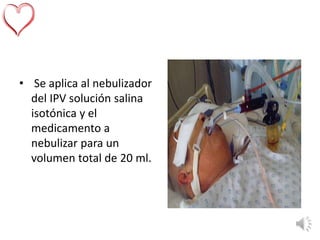 • Se aplica al nebulizador
del IPV solución salina
isotónica y el
medicamento a
nebulizar para un
volumen total de 20 ml.
 