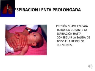 ESPIRACION LENTA PROLONGADA
PRESIÓN SUAVE EN CAJA
TORAXICA DURANTE LA
ESPIRACIÓN HASTA
CONSEGUIR LA SALIDA DE
TODO EL AIRE DE LOS
PULMONES
 
