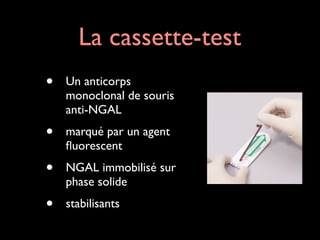 La cassette-test
•

Un anticorps
monoclonal de souris
anti-NGAL	


•

marqué par un agent
ﬂuorescent	


•

NGAL immobilisé sur
phase solide	


•

stabilisants

 