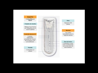 Sample Port
L’échantillon est
déposé

Filtre

Chambre de réaction

Séparation GR/
plasma

Mélange d’une fraction
de l’échantillon avec le
réactif lyophilisé

Controles internes (3)
Contrôles
indépendants
permettant de s’assurer
que la réaction a lieu
convenablement

Poubelle
L’échantillon est
collecté

Réaction
Une surface
hydrophobe assure le
temps de réaction

Zone de lecture
L’échantillon à doser
et les Ac fluorescents
sont stockés dans des
zones distinctes

 